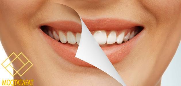 التَخلص من اصفرار الأسنان